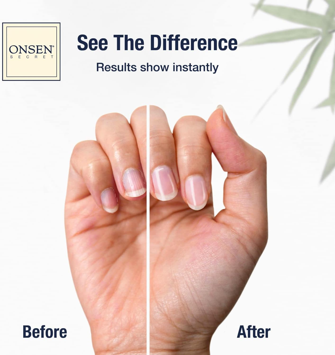 Onsen Nail & Cuticle Cream Treatment W/Japanese Tsubaki, Jojoba & Lavender Oil, Shea Butter &ndash; Strengthens Nails, Softens Cuticles - Daily Repair Care (1 Count/15 Ml)