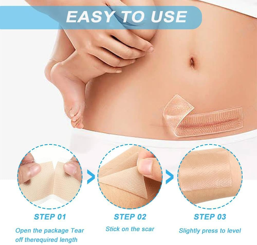 Silicone Scar Sheets, Soft Easy Tear Silicone Scar Tape (1.6"X 120" Roll-3M), Reusable Scar Removal Sheet, Scar Removal Away Strips for Surgical Scars, Keloid Scars, C-Section, Tummy Tuck, Acne Etc.