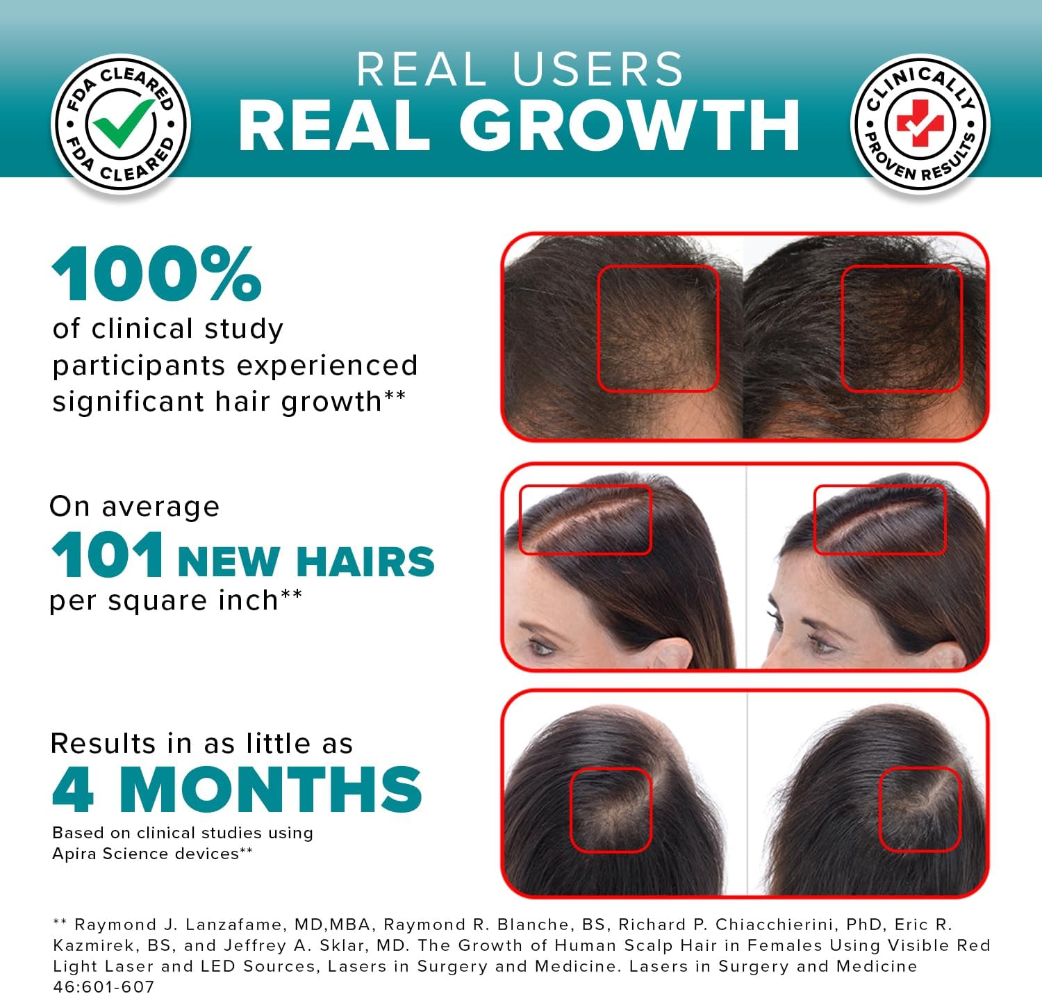 Igrow Laser Hair Growth Helmet: Restoration & Regrowth Treatment System for Hair Loss - Natural Thinning, Balding, and Alopecia Solution for Women and Men - Fda Cleared Low Level Laser Device image number 1