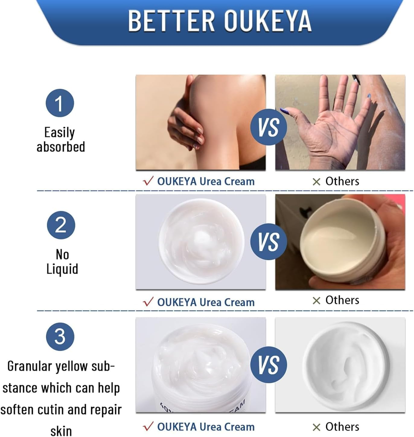 Urea Cream 40%, Keratolytic Foot Cream for Dry Cracked Heels, Feet, Knees, Elbows, Hands, Cuticle, Callus Remover, Skin Barrier Repair (2)