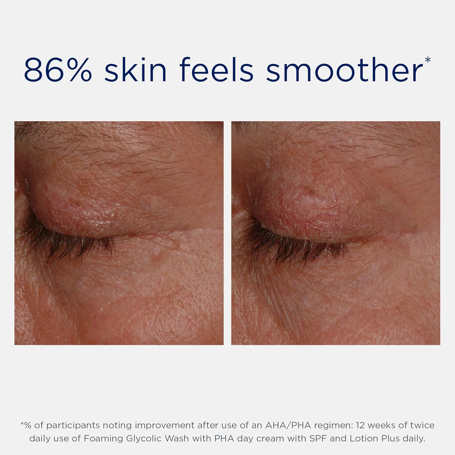 Neostrata Resurface Fragrance Free Lotion plus 200Ml image number 3