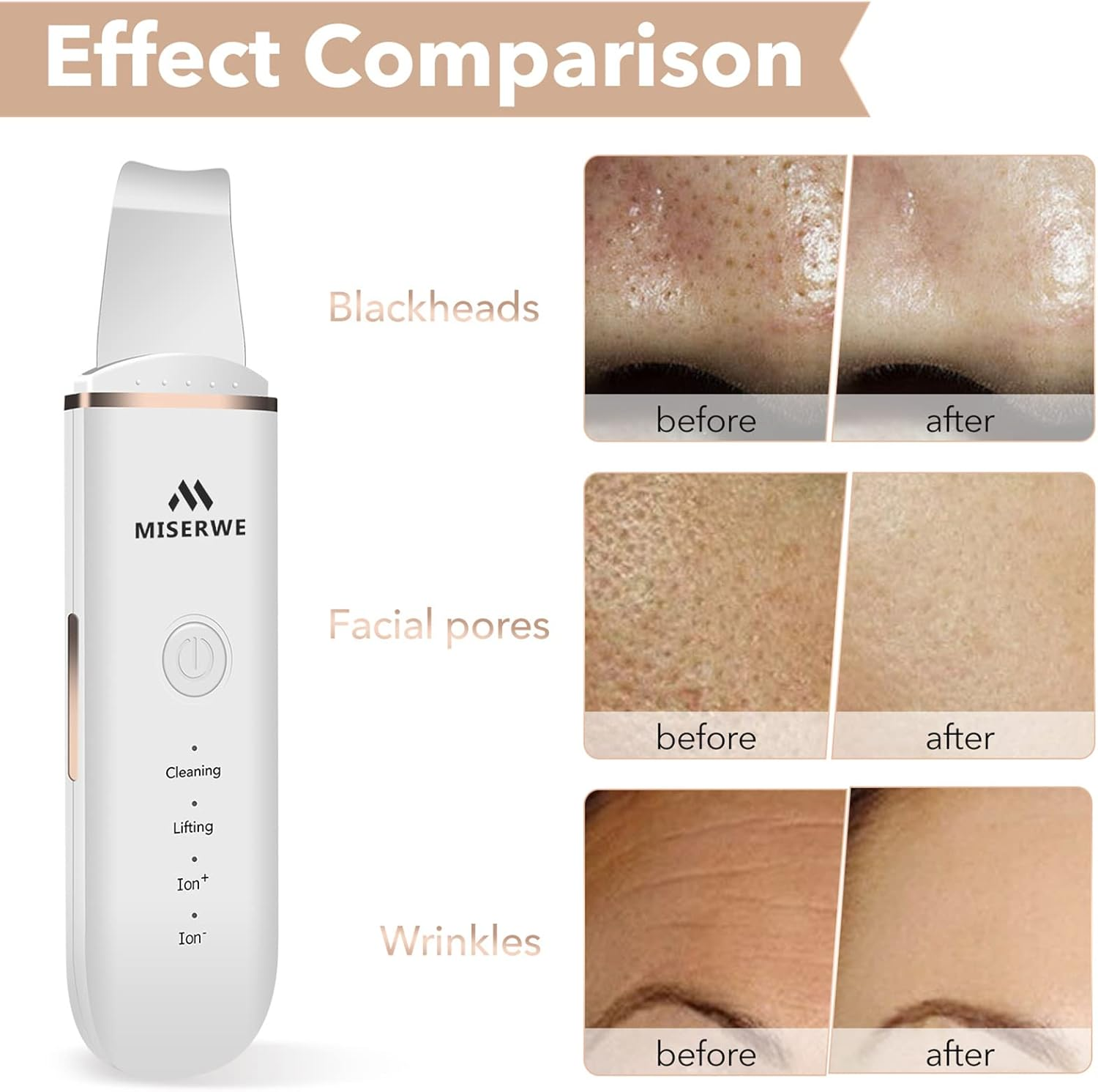 Skin Scrubber Face Skin Spatula Blackhead Remover Pore Cleaner Face Beauty Lifting Tool Comedones Extractor with 4 Modes, Facial Scrubber Spatula for Deep Cleansing with Two Silicone Case