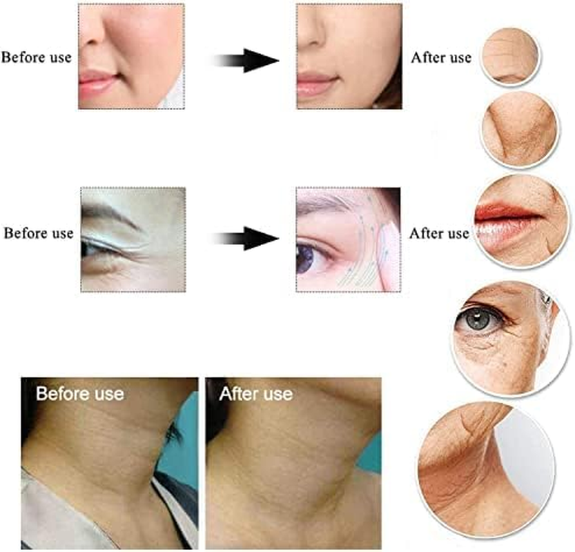 16Pcs Silicone Anti-Wrinkle Patches for Forehead, Eyes and Chin, Washable and Reusable for Enhance Skin Elasticity and Lift Skin