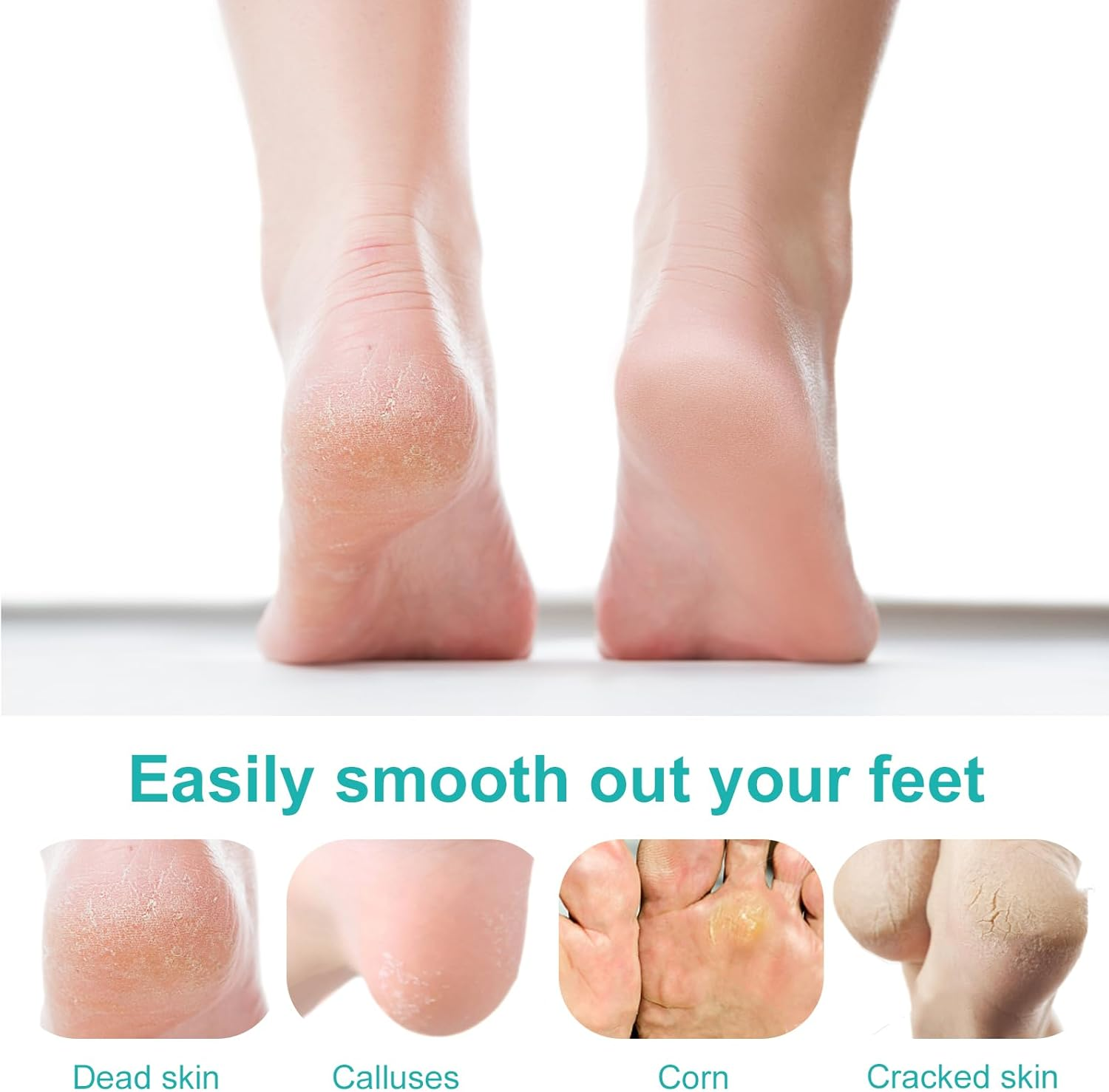 3 Replacement Rollers Callus Remover Electric 3 Types of Rough for Callus Corn Removal, Foot Care Equipment Accessories for Pedicure Foot Care Set image number 1