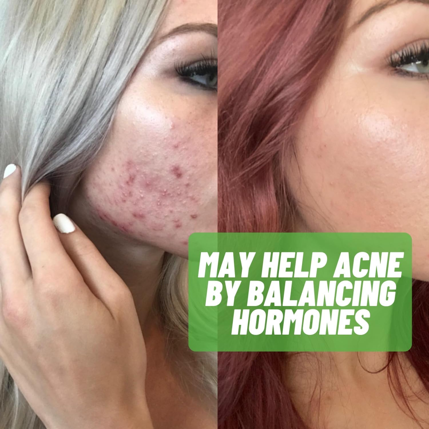 Estrogen-Blocker Supplement & Natural anti Aromatase Inhibitor Pills for Men & Women DIM (Diindolylmethane) & Indole 3 Carbinol (I3C) Supplements for Estrogen Dominance & Hormone Balance image number 5