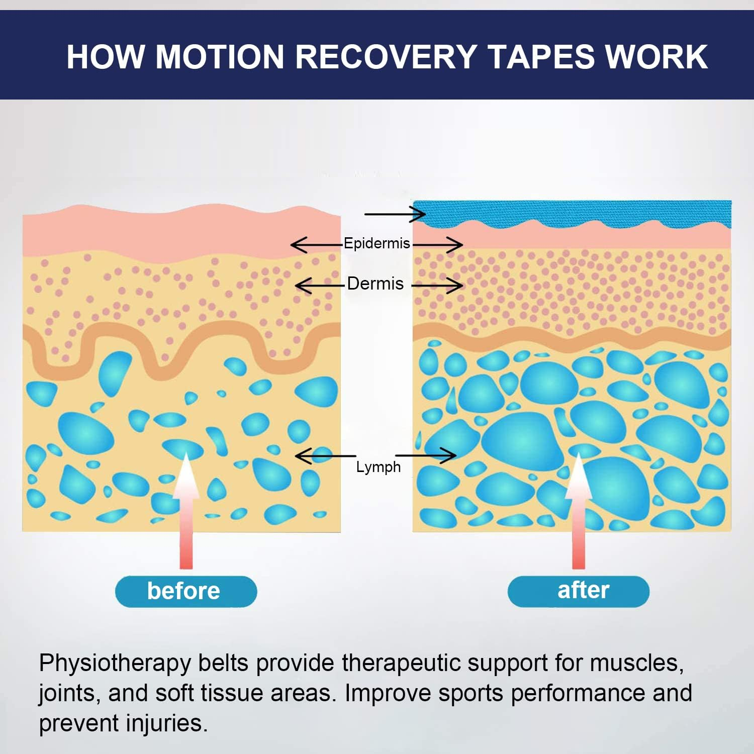 6 Packs Athletic Sports Waterproof Unisexs Kinesiology Tape 5Cm&times;5M,Sports Tape Strapping,Elastic Muscle Support Tape for Exercise & Sports,Provides Support for Muscles and Joints, Knees,Shoulders to Reduce Pain and Injury Recovery,Latex Free image number 2