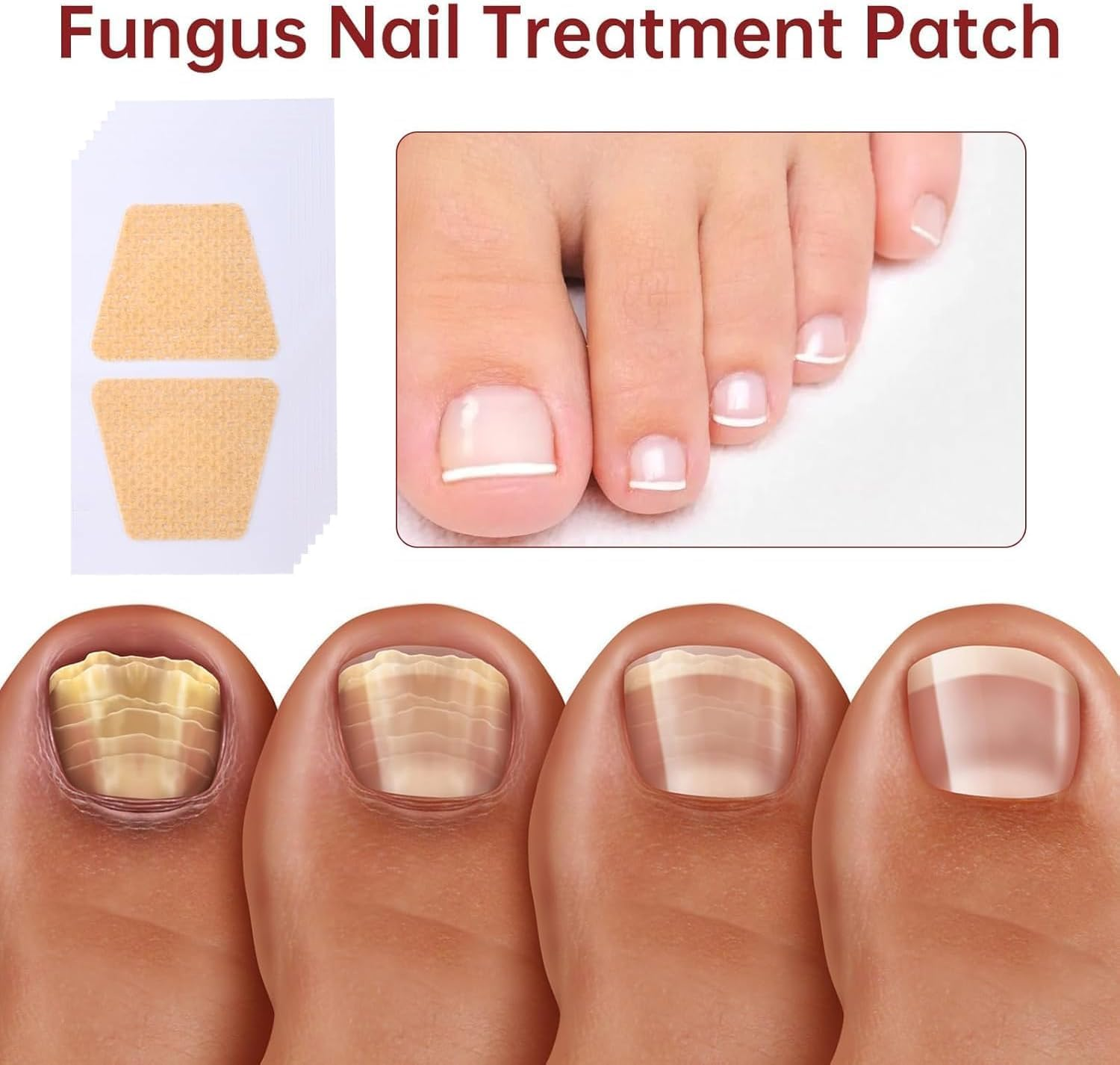 32PCS Fungal Nail Patches,Toe Nail Fungus Treatment, Nail Fungal Patches for Toenail,Nail Fungus Treatment,Yellow Toenail Patch for Fungi Nail,Nail Fungus Plasters, Active Nail Repair & Care image number 3