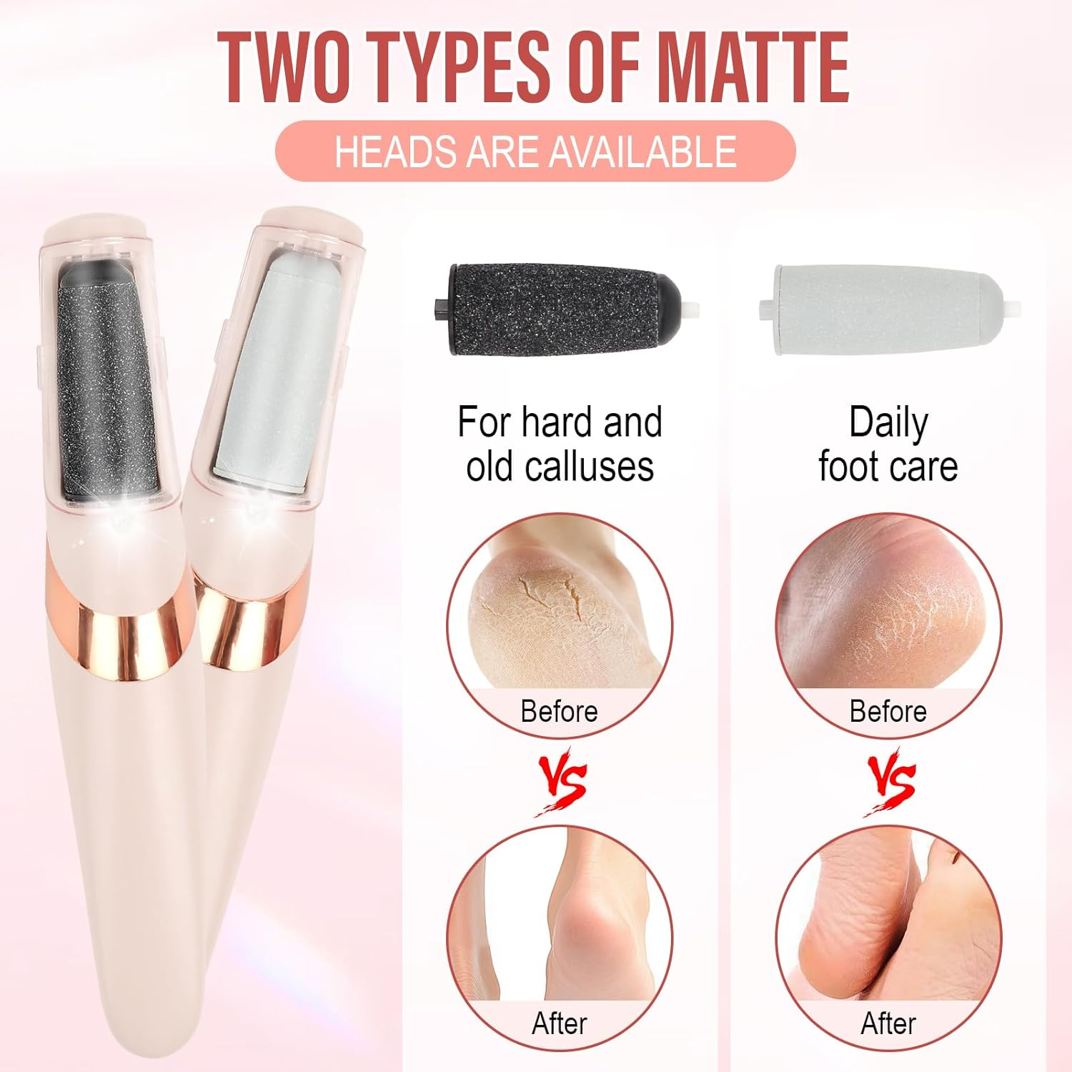 Electric Callus Remover, Callus Removal Foot, Electric Callus Remover, Electric Callus Remover Feet, Electric Callus Remover Electric Batteries image number 1