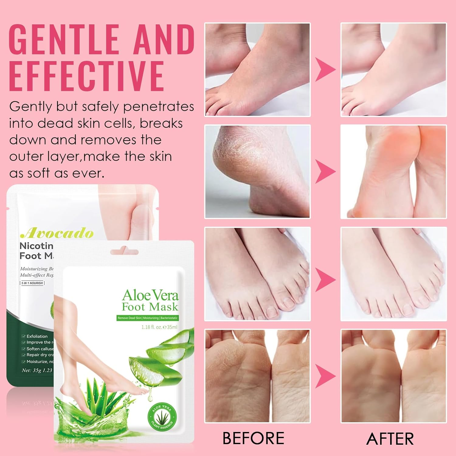 2 Pairs Foot Peel Mask, Feet Exfoliating Mask, Moisturizing Socks, Restoring Cracked Heel Dead, Dry & Hard Skin, Removes Dead Skin & Repairs Heels for Soft Feet, Aloe + Avocado