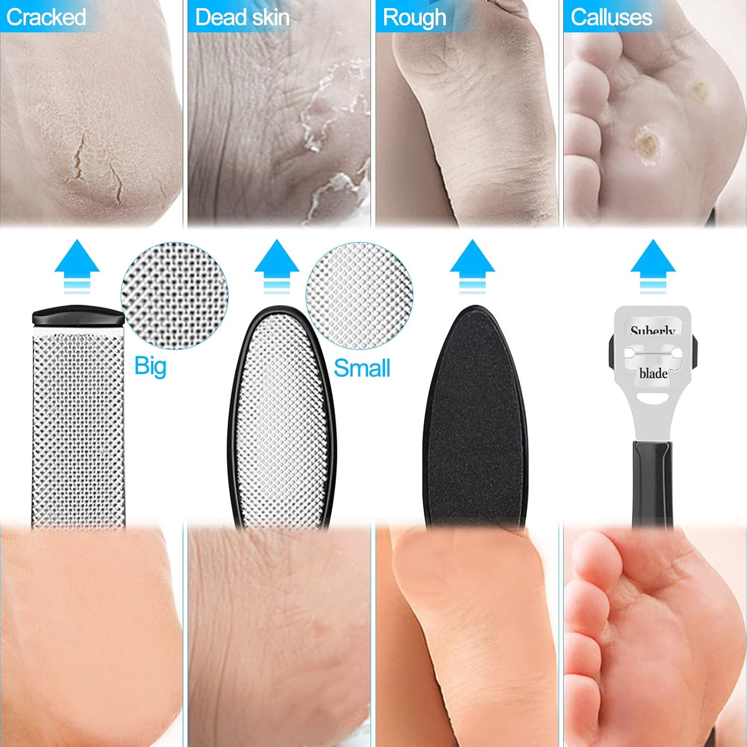 Sularpek Pedicure Kit, 10 in 1 File Feet, Pedicure Scraper, Pedicure Kit for Hard Skin Remover and Calluses, Foot Care