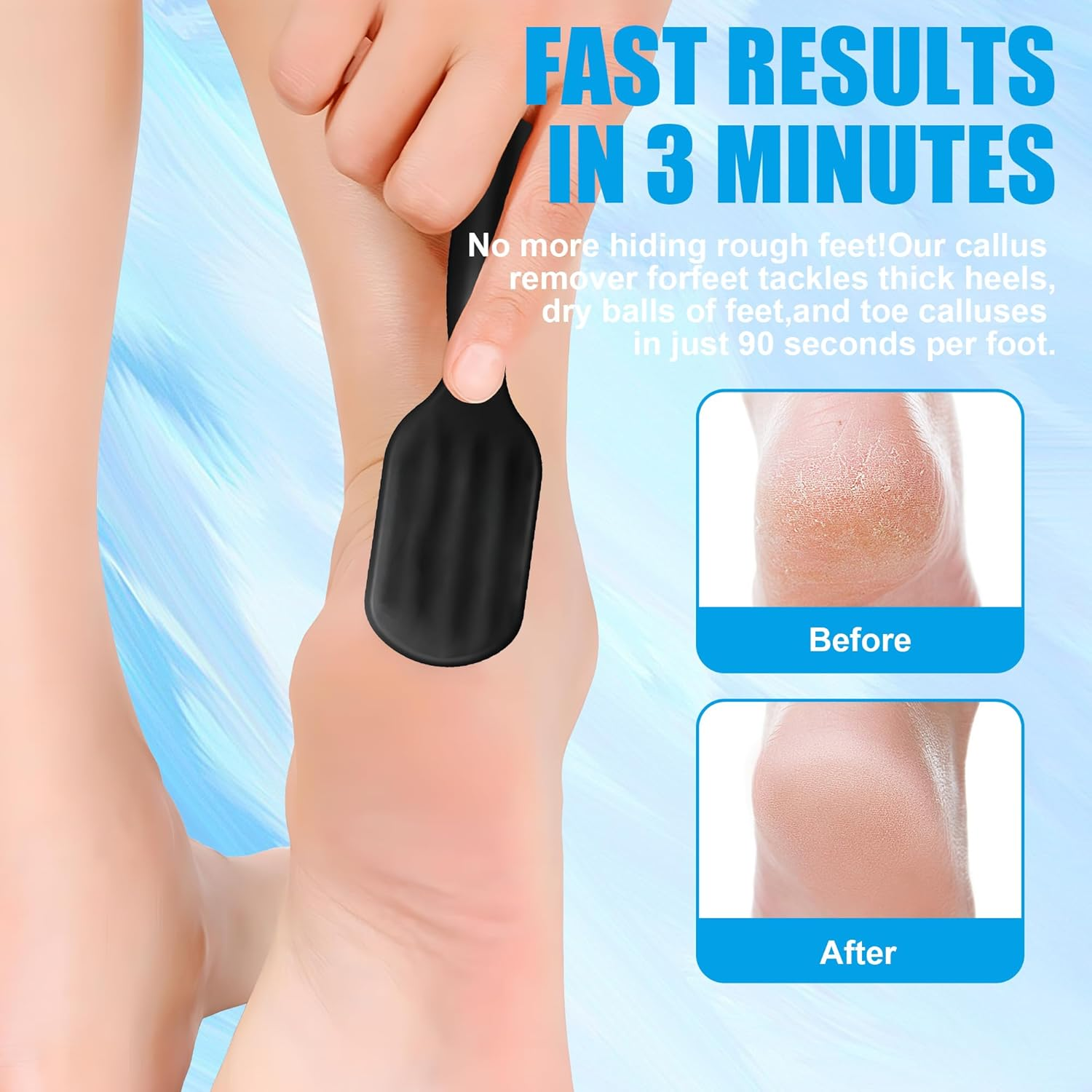 Foot File Callus Remover with Dead Skin Catcher - Mess-Free Wet & Dry Foot Scrubber and Heel Scraper for Cracked Heel Treatment, Home Pedicure & Travel Essential for Men and Women (Black) image number 6