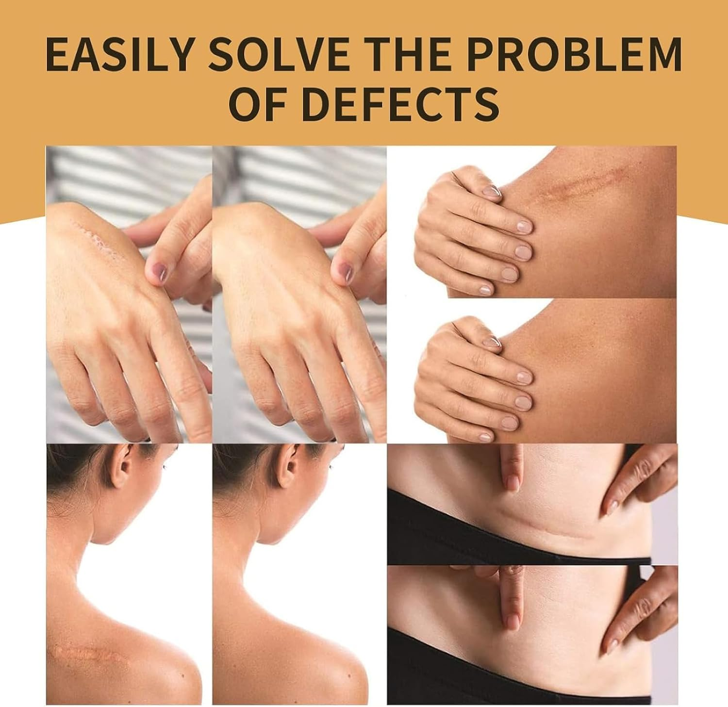 Muhomuho 10Pcs Tattoo Cover up Patch, Scar Tape, Second Skin for Tattoo, Invisible Waterproof Body Concealer Makeup Sticker, Natural Looking Cover up for Tattoos & Scars (Light) image number 4