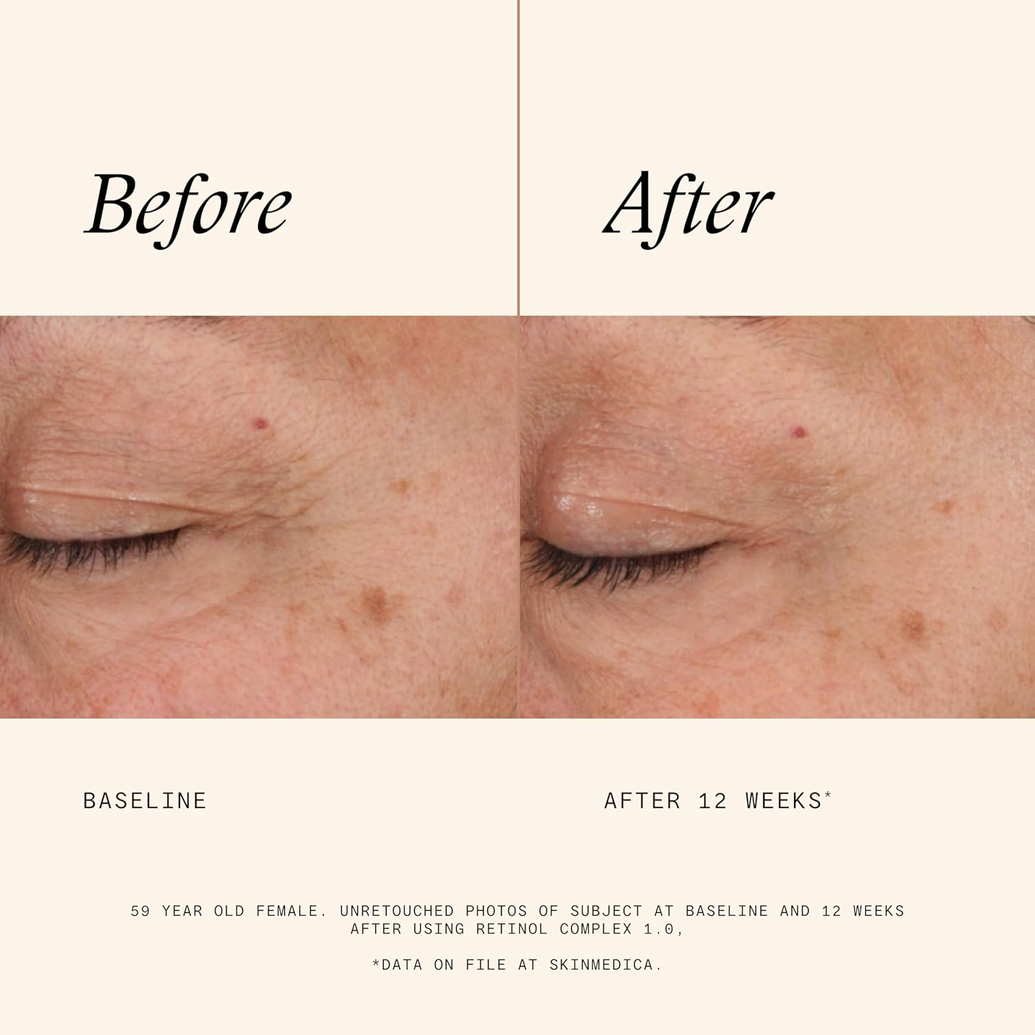 Skinmedica Retinol 1.0 Complex - Retinol Serum for Face, Age-Defying Advanced Retinol Cream That Renews Skin and Diminishes the Appearance of Fine Lines and Wrinkles, 1 Fl Oz image number 3