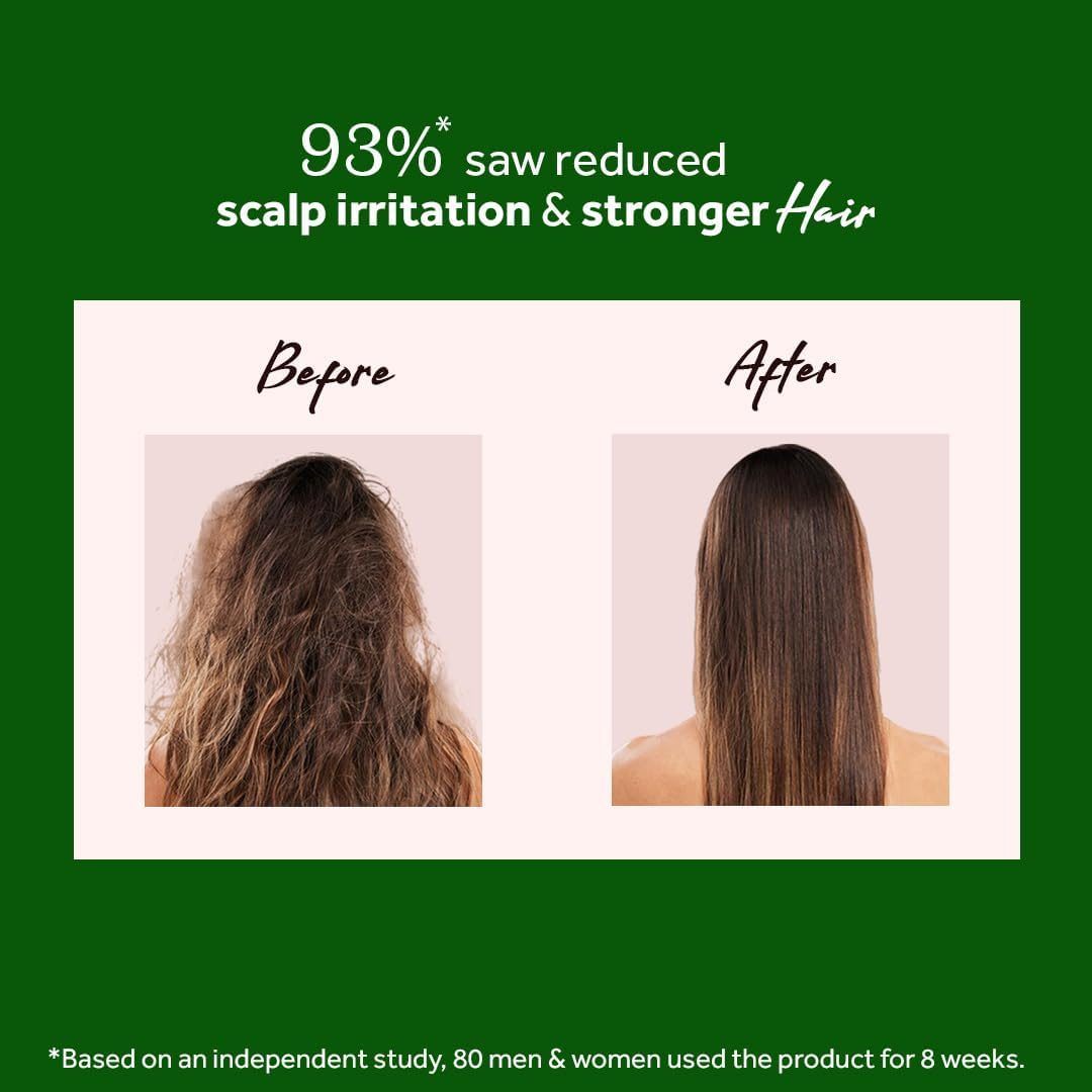 Atulya Neem & Sage Hair Mask - Sulphate & Paraben Free (100% Natural) | Natural Hair Mask, Herbal Hair Mask | Hair Conditioner for Dry Frizzy Hair, Hair Fall Control, Hair Nourish image number 5