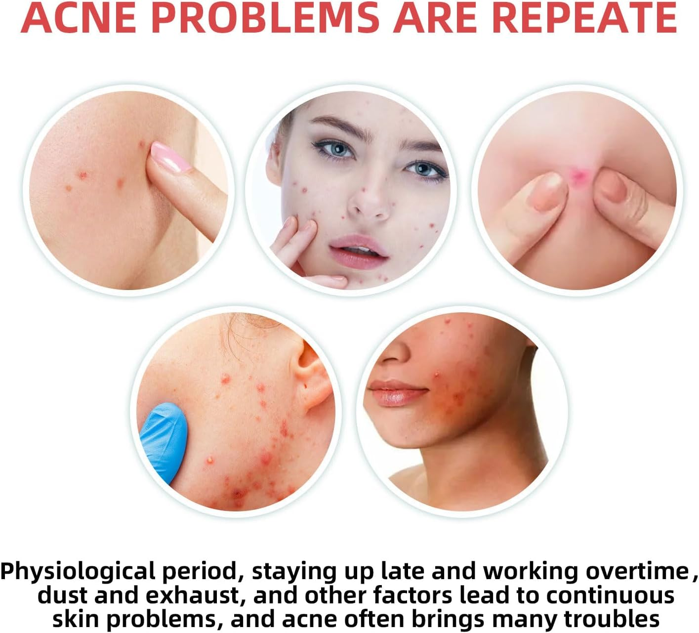 CTOUUGRS Pimple Patches for Face Hydrocolloid Patch Acne Patches Professional 400 Pcs 5 Colors&Sizes(8,10,12,14,16Mm) Starface Pimple Patches Matches Different Size Cute Star Spot Stickers Invisible Zit Absorbing Covering Tea Tree image number 3