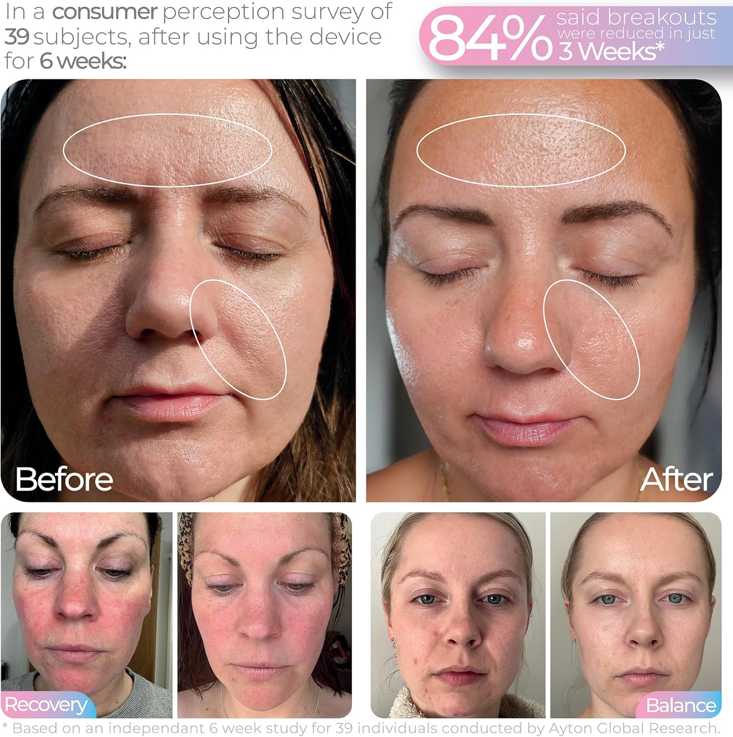 STYLPRO Wavelength LED Face Mask - Multi-Mode Skincare with Red, Blue, Near-Infrared Light for Wrinkles, Blemishes - Flexible, Rechargeable, User-Friendly, Designed in UK, Professional-Grade image number 6