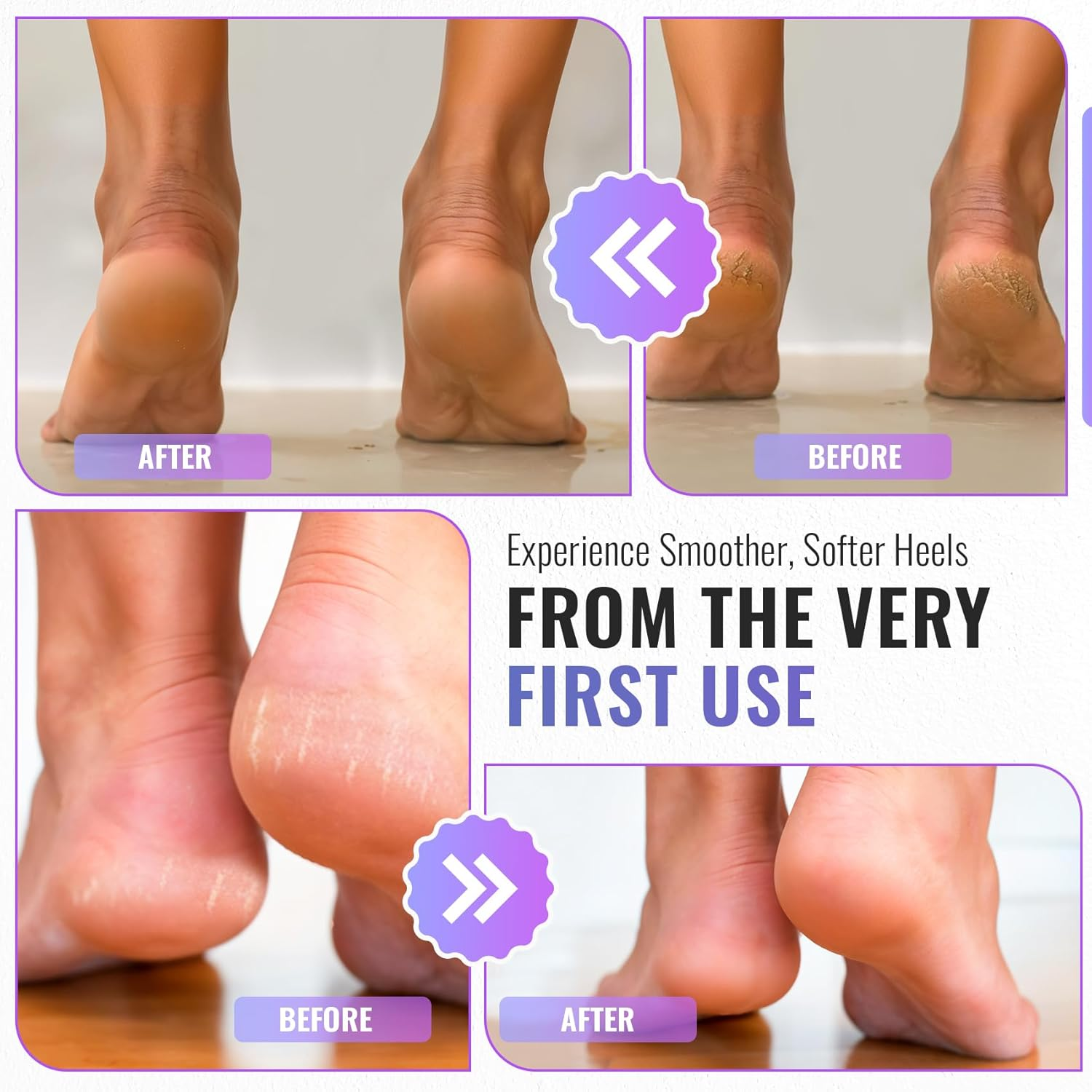 TYGA Foot Rasp Foot File and Callus Remover - Pedicure Tool for Removing Dead Skin, Feet Hard Skin Remover, Foot Scraper, Can Be Used on Both Wet and Dry Feet image number 2