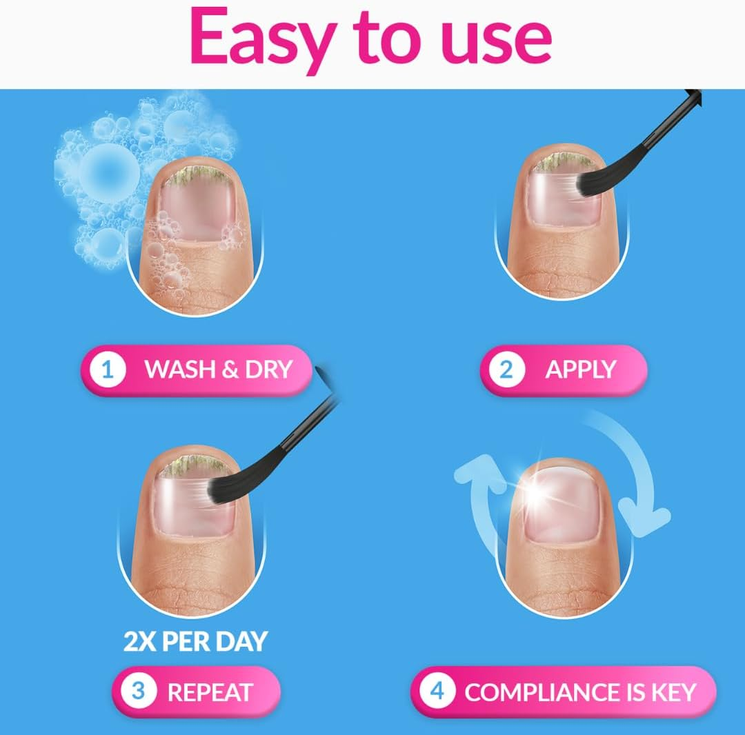 EXCILOR - Effective Nail Fungus Treatment - Solution - Returns Infected Nails to Healthy & Beautiful - Fast Penetration - Easy Brush Application - No Filing - Clinically Proven - 3.3Ml