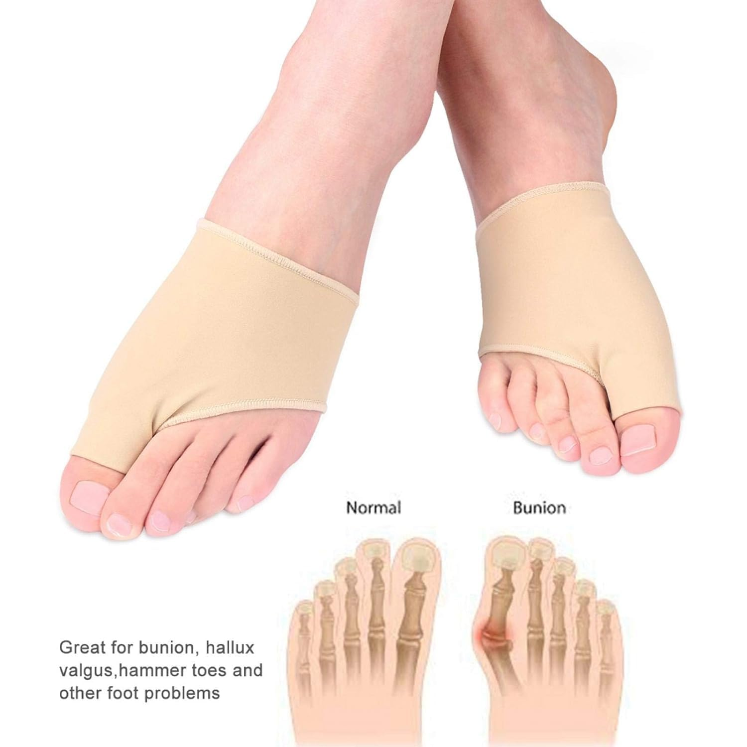 2Pair Bunion Corrector Bunion Relief Sleeves for Big Toe Straightener,Orthopedic Corrector Brace Protector Bootie Toe Separator for Men Women Hallux Valgus at Day Harmer Toe Elder image number 2