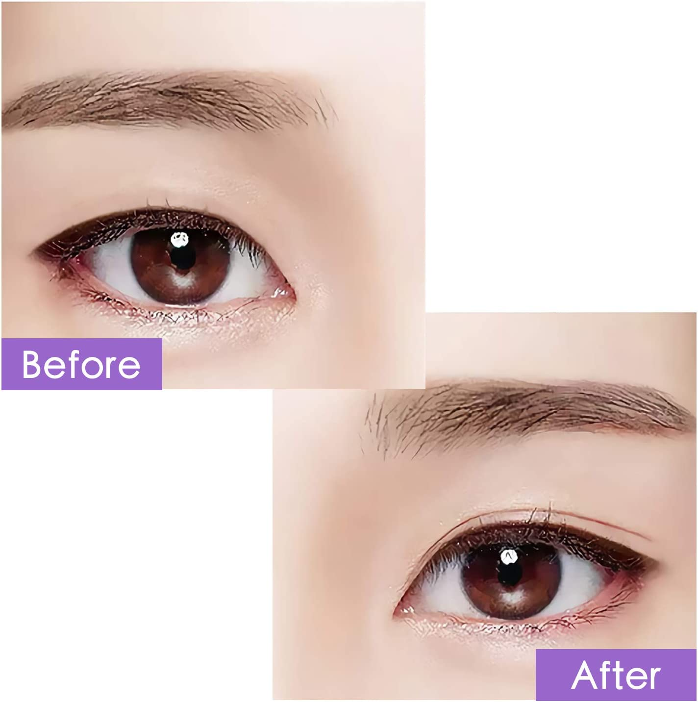 2 Packs Invisible Double Side Eyelid Tapes Stickers, Medical-Use Adhesive Eyelid Strips, Instant Eye Lift without Surgery, Perfect for Hooded, Droopy, Uneven, Mono-Eyelids image number 3