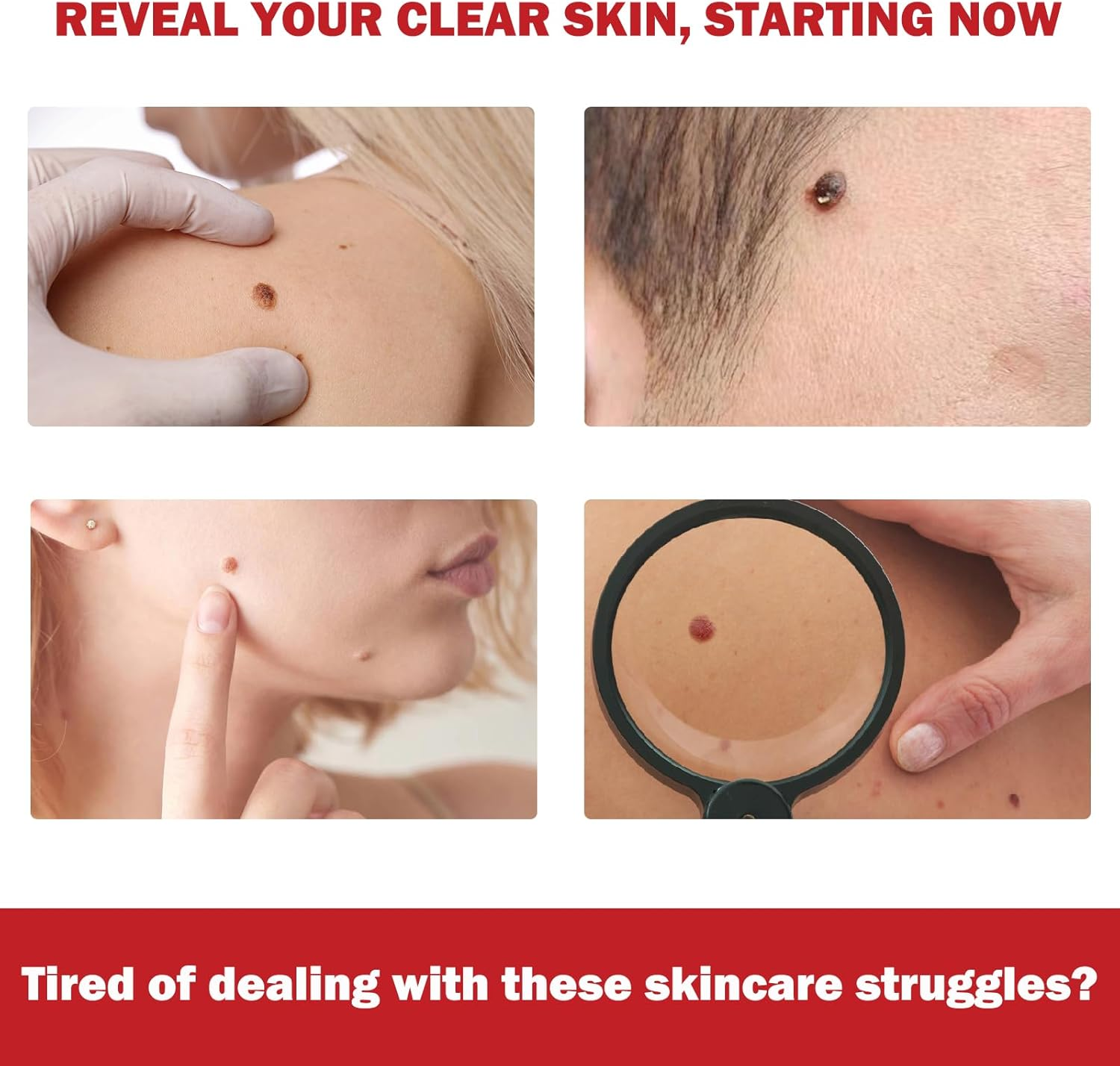 18Pcs Microneedle Skin Tag Patches &ndash; Gentle Microdarts with Plant-Based Formula, Sweatproof Daily Care Stickers for Face & Body, Comfort Fit for Sensitive Skin Designed for Daily Use（2 Pack） image number 6