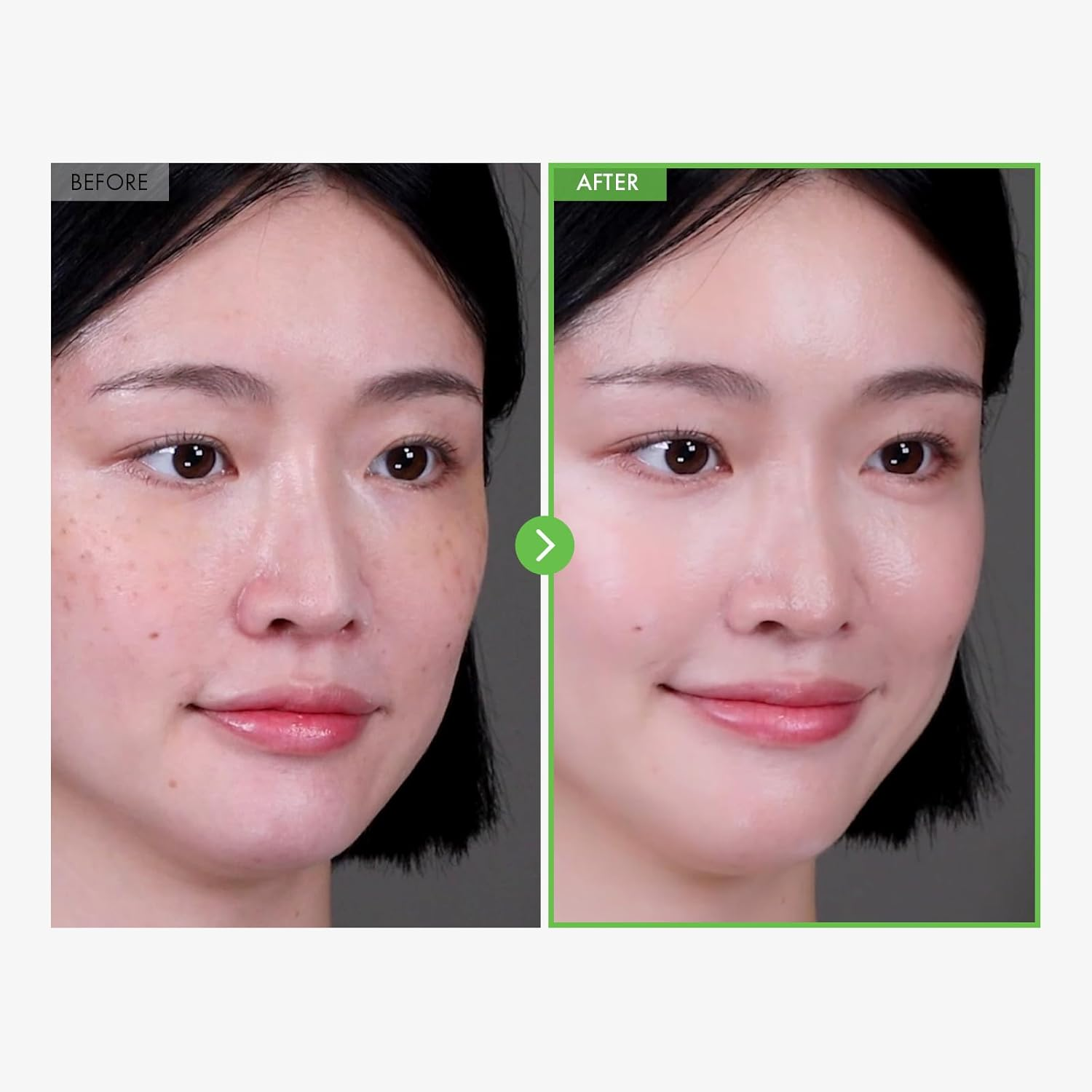 TOSOWOONG Kakadu Plum Blemish Cream, Dark Spot Remover for Face Cream, Kakadu Plum 600,000Ppm, Niacinamide, Adenosine, Betaine, Dark Spot Corrector, Vitamin C, Korean Skin Care, 50G, 1.76 Oz. image number 2