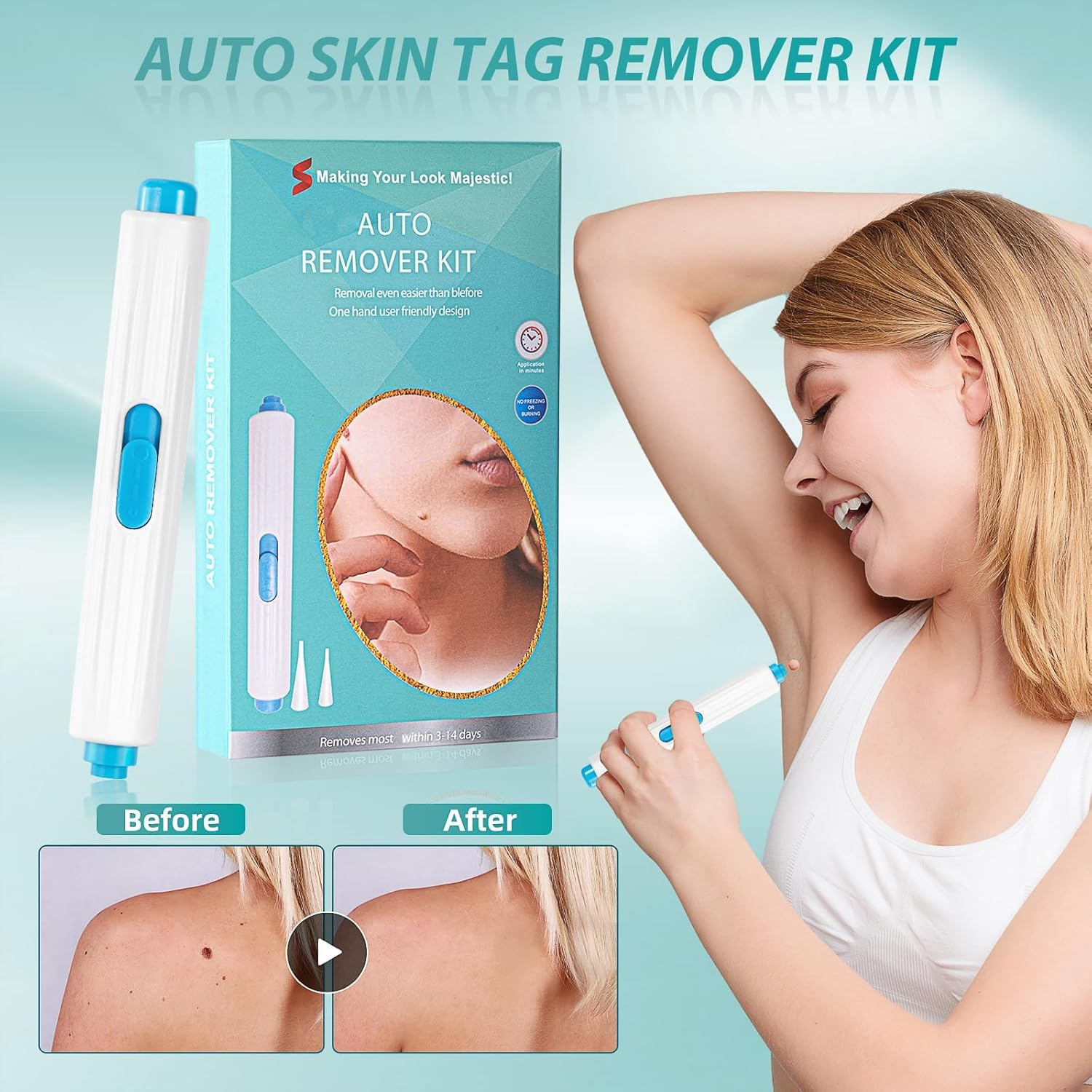 Skin Removal Kit, for the Removal of Skin Tags and Warts, Safe and Effective to Be Used at Home image number 3