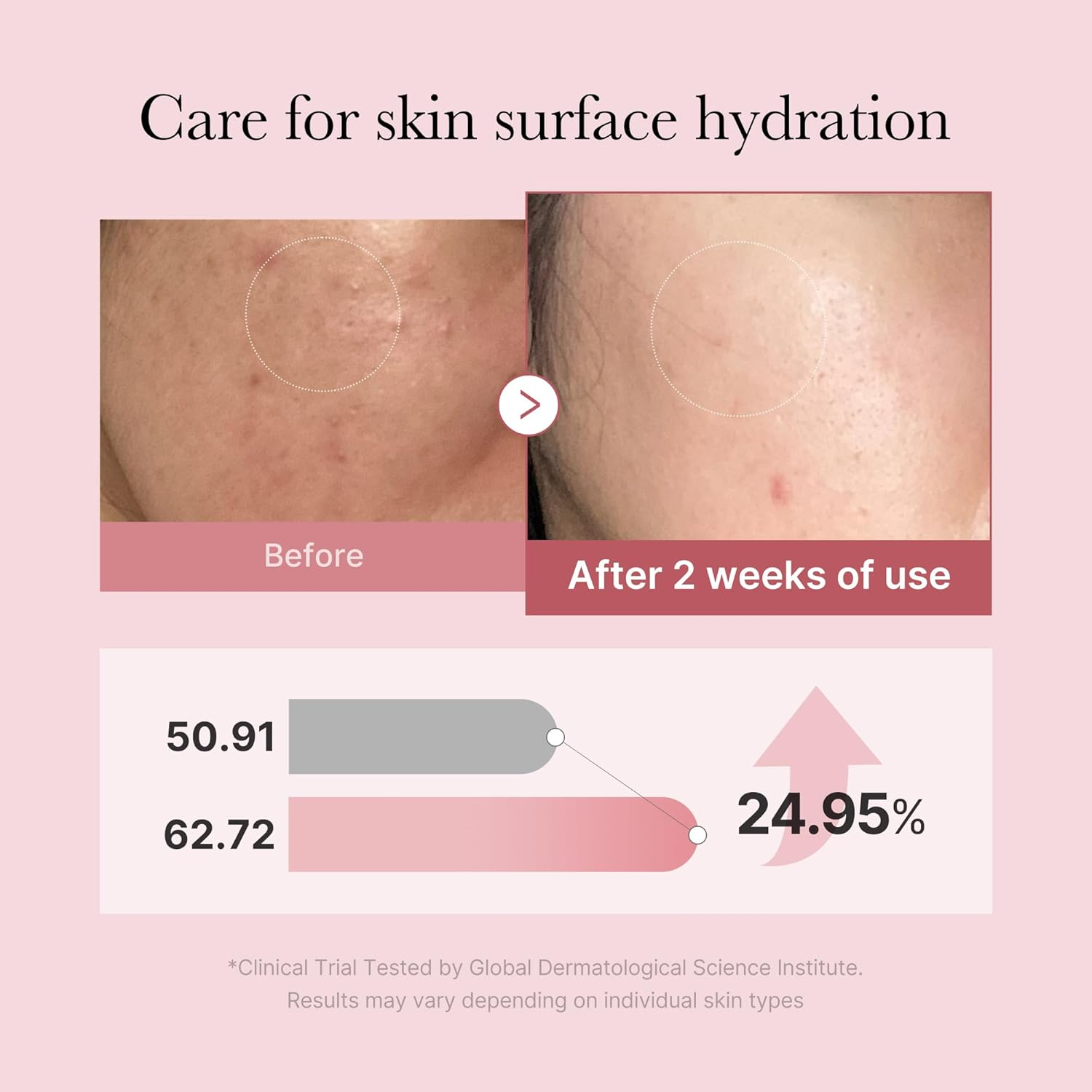 Medicube PDRN Pink Cica Soothing Mist image number 5