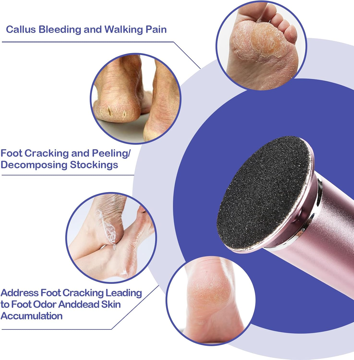 Replacement Sandpaper Discs Pad, 120 Mesh Callus Removal Pedicure Foot File Tools Accessories for Electric Foot File Pack of 120