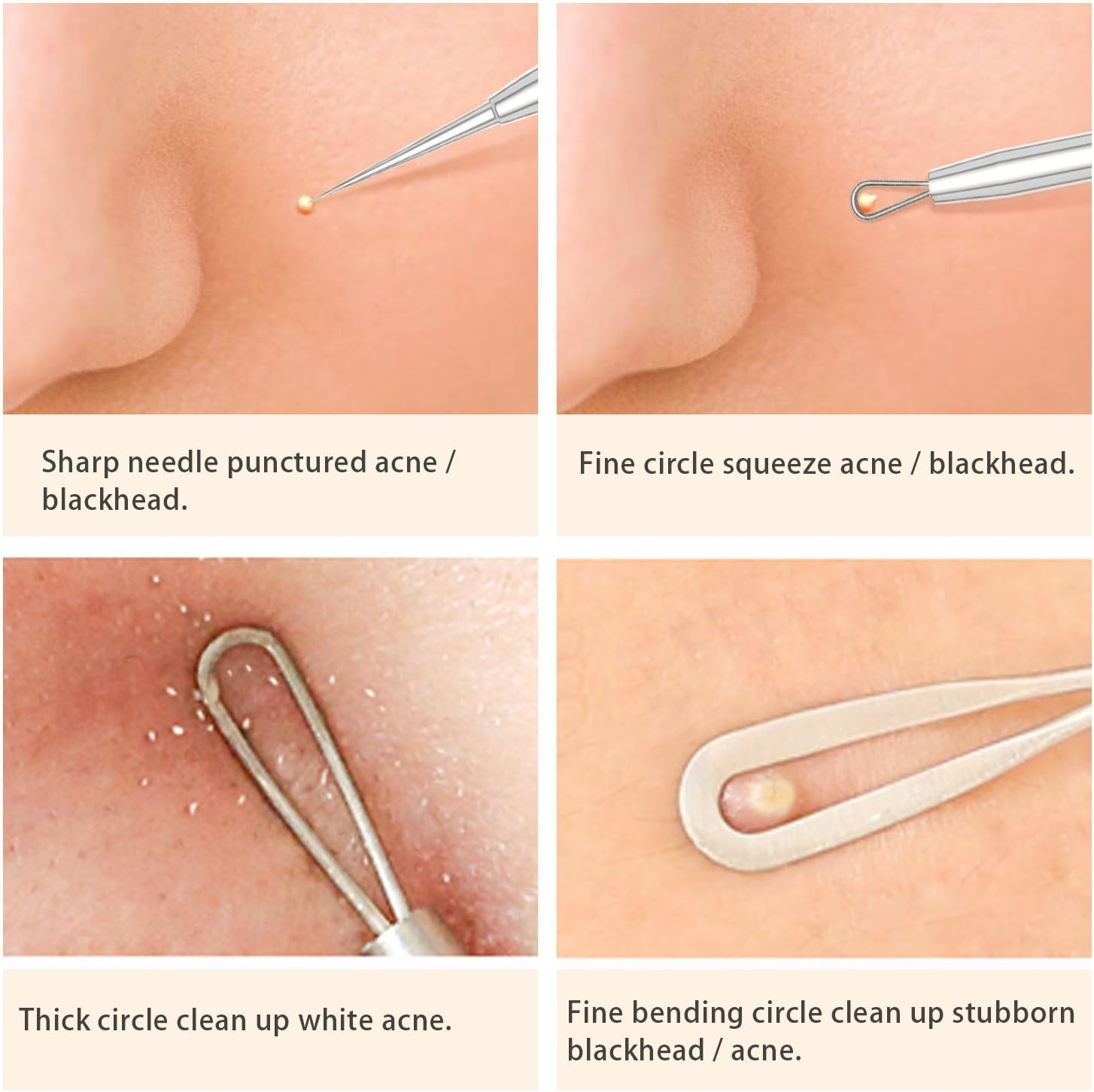 Blackhead Remover Tools with Camera Visible Pore Cleaner Waterproof Acne Comedone Whitehead Extractor Kit for Iphone/Android image number 3