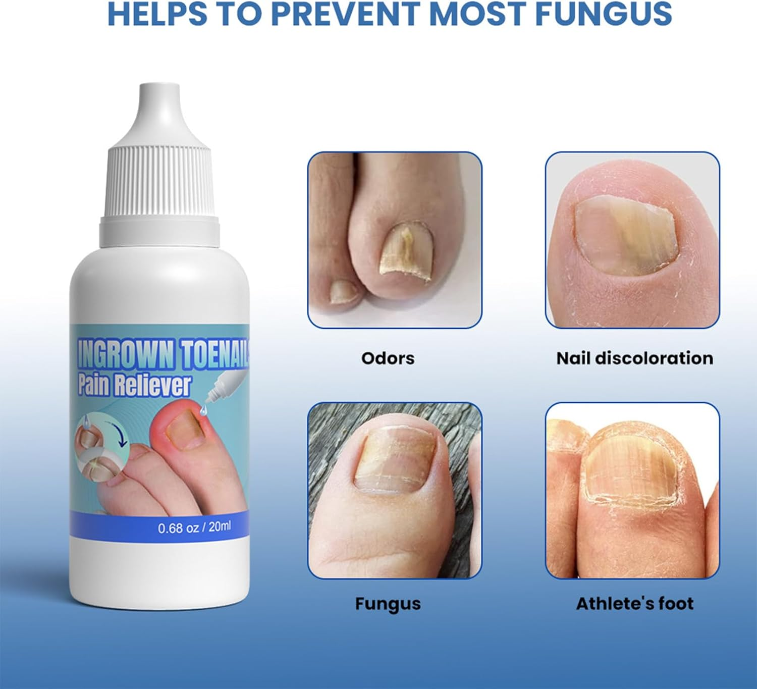 Ingrown Toenail Treatment - Ingrowing Toenail Treatments - Ingrown Nail Treatment for Toenails Extra-Strong
