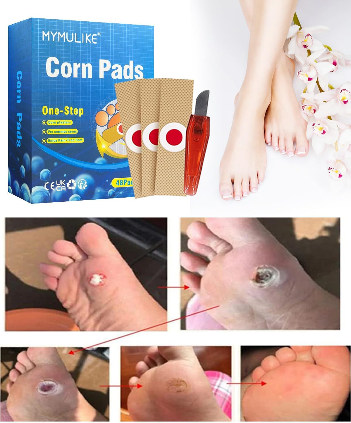MYMULIKE 48Pcs Corn Removers for Toes & Feet, Tackle Tough Corns with Ease, 0.4" Diameter Large Size, Experience Quick Recover with Powerful, Easy-To-Use Corn Removal image number 3