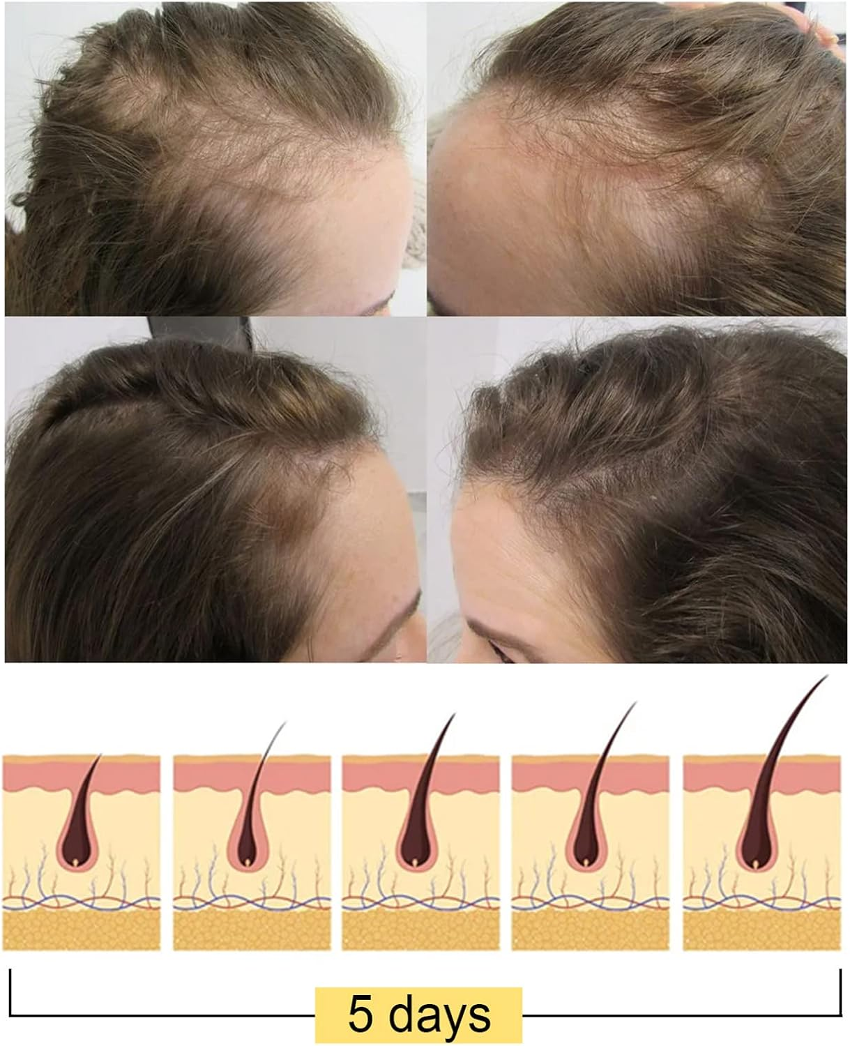 Daseey 1Pc Hair Growth Rice Soap Shampoo Bar Nourish Hair Root Balance Oily Scalp Increase Hair Volume