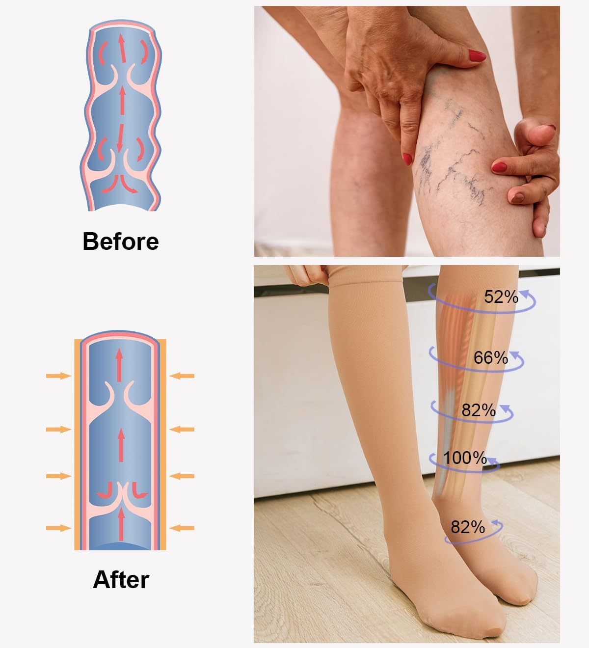 2 Pairs of Medical Compression Stockings for Men and Women, 20-30 Mmhg, Class 2, Closed Toe, Graduated Support, Support Stockings for Varicose Veins, Edema, Flight, 2 X Beige, Medium