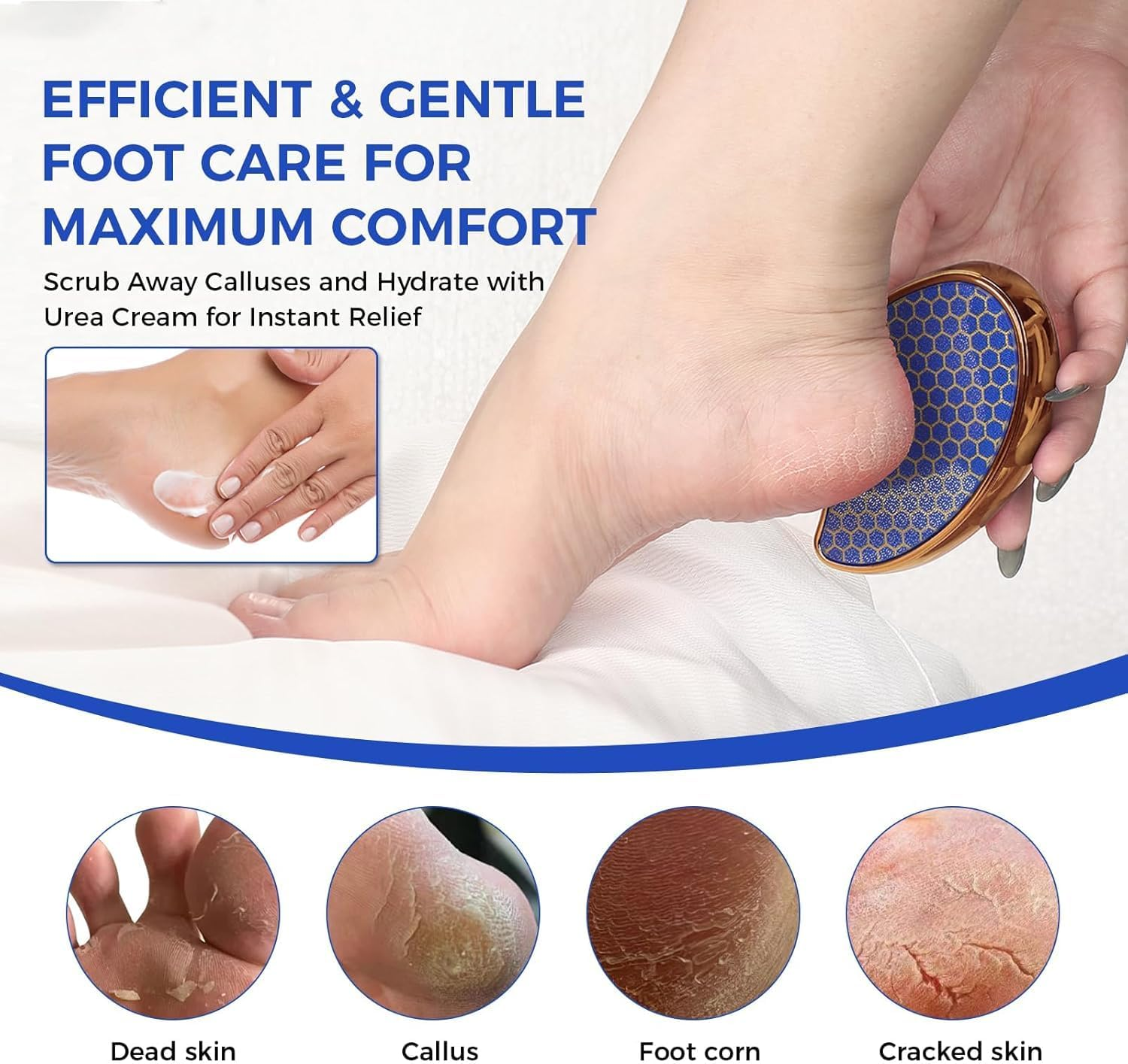 OUKEYA 40% Urea Cream, Foot & Hand Cream with Foot File, Maximum Strength Moisturising Lotion for Dry Cracked Skin, Softening Care for Feet, Heels & Hands, Intensive Hydration, 150G