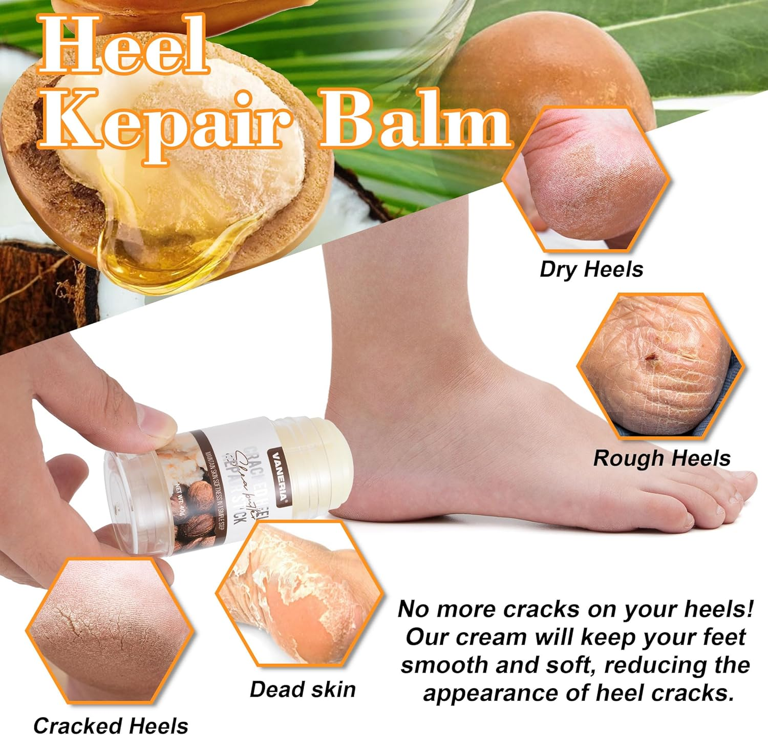 VANERIA Cracked Heel Repair Stick,Heel Balm for Dry Cracked Feet Treatment with Shea Butter & Coconut Oil,Deeply Moisturize & Soften Feet,Exfoliates Dead Skin 40G (Pink) - Pink image number 6