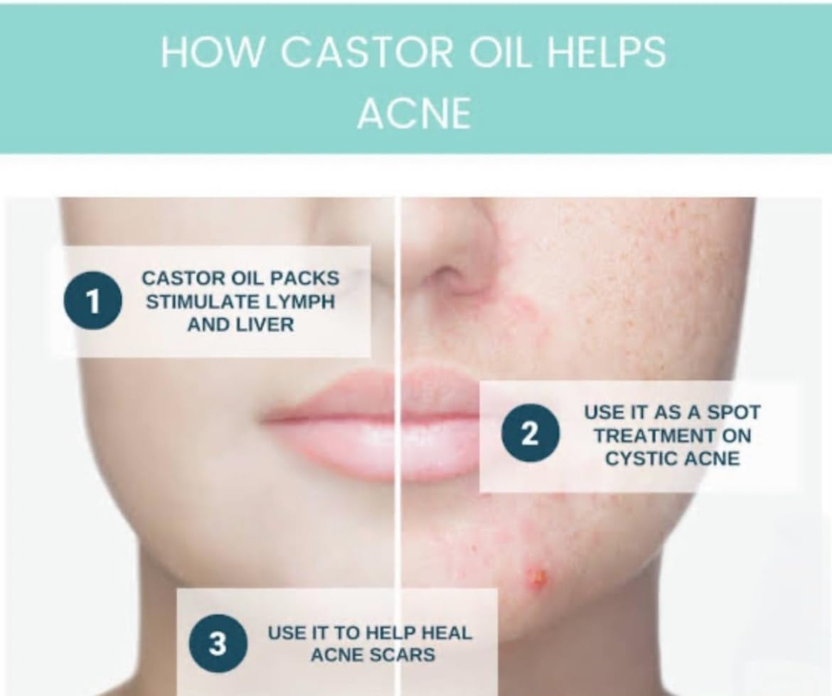 D-HUB AU: 100Ml Organic Castor Oil Pure Cold Pressed Hair Oil Lash Serum, Certified Pure Castor Oil for Hair Growth Serum, Castor Oil Pack Hexane Free for Eyebrows, Eyelash Serum, Scalp Oil, Beard Growth Oil , Body Massage Oil for Dry Skin | Packaging in Australia May Vary. image number 2