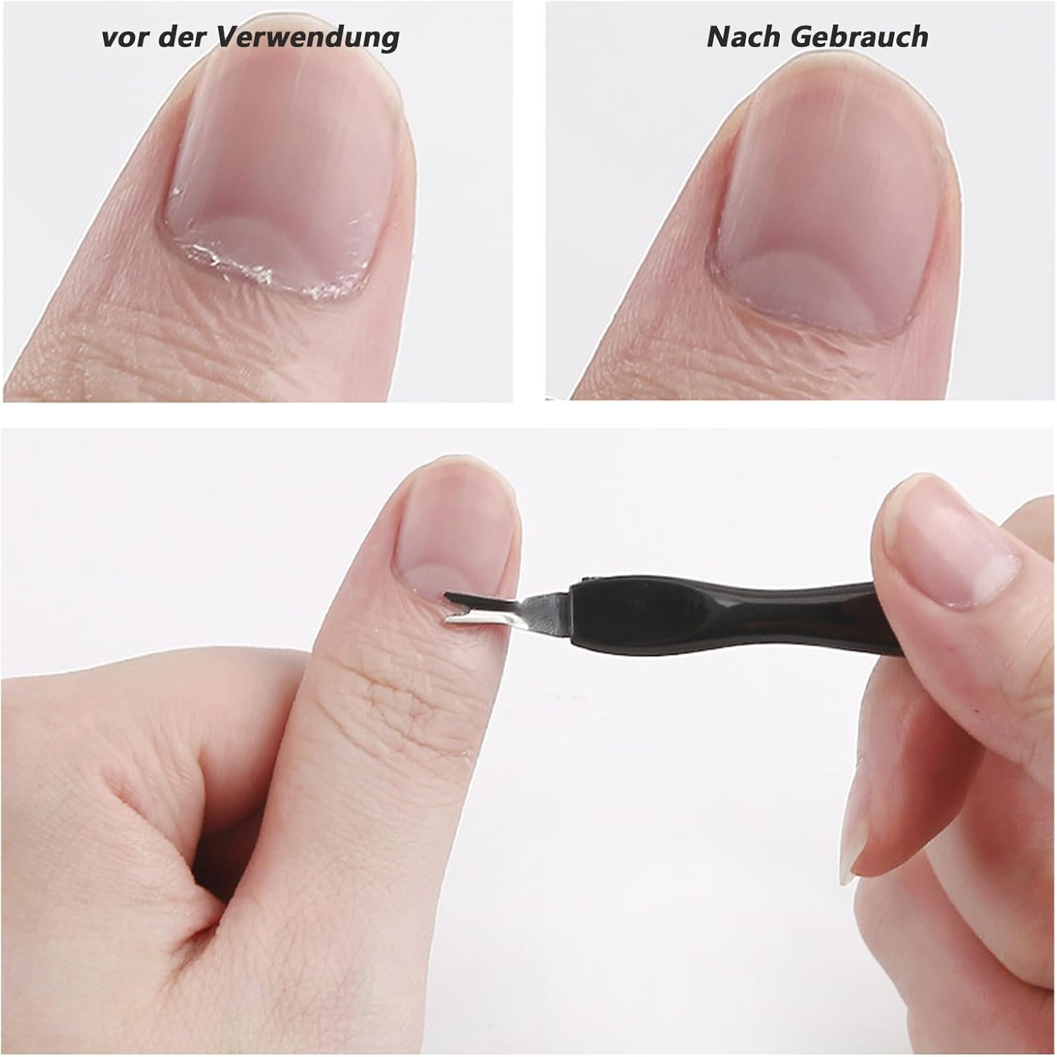 Pack of 6 Callus Removers, Callus Removal Foot, Callus Oble, Rasp, Callus File, Callus File Foot, Double-Sided Stainless Steel Foot File, Callus Rasp, Callus Remover image number 5