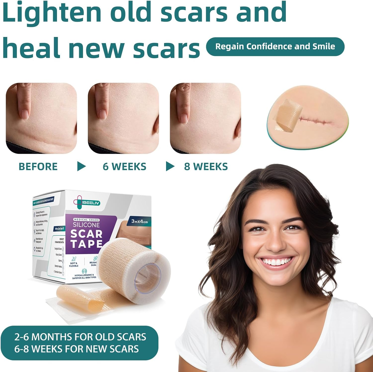 Silicone Scar Tape for Surgical Scars: 3 Meters Scar Gel Sheets for C-Section Tummy Tuck Recovery and Treatment &ndash; Reusable Scar Strips for Keloid Burn Scars Removal (1.6'' X 120'' Roll-3M) image number 4