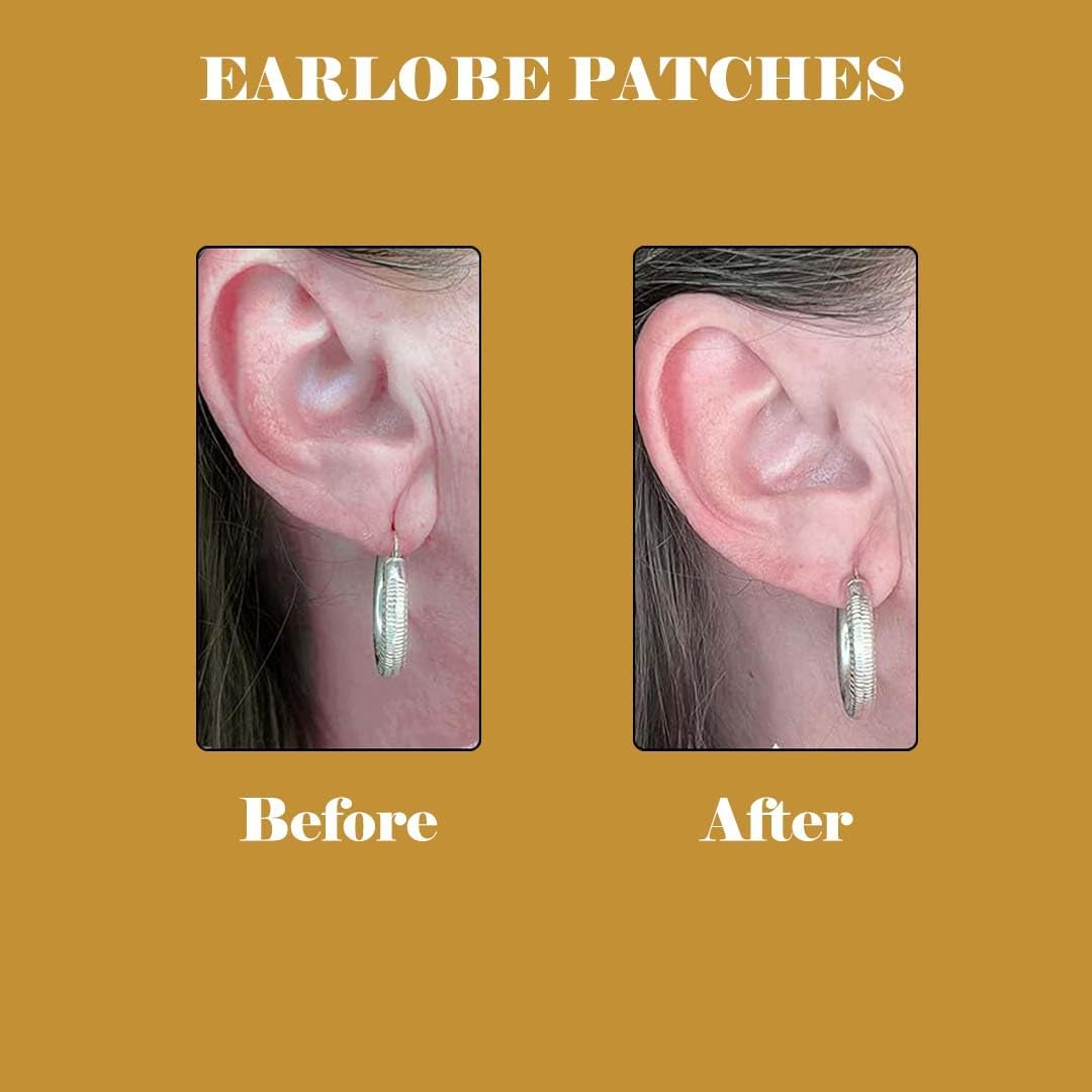 Aayuleubeda Badi Care ABC - Ear Lobe Support Patch for Heavy Earrings (Pack of 30) image number 4