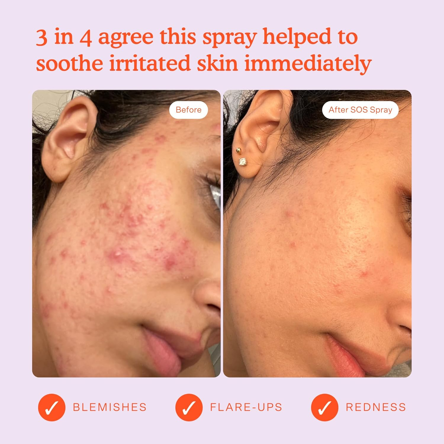 Tower 28 Beauty Mini SOS Daily Rescue Facial Spray 1 Ounces image number 5