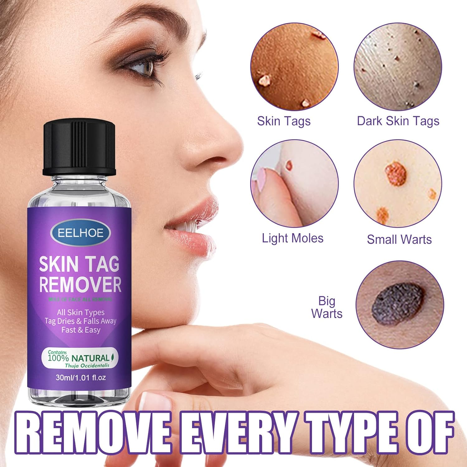 Skin Tag Remover - Professional Grade Fast Acting Liquid for Skin Tags, Moles & Warts Removal - Painless Treatment for Face & Body - 30Ml Easy Application Bottle image number 1
