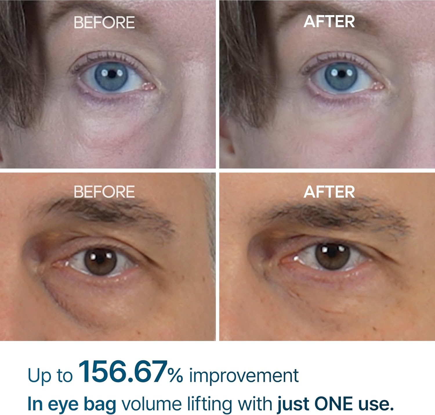 DR MELAXIN - Eyephalt Eyebag Cream 10Ml