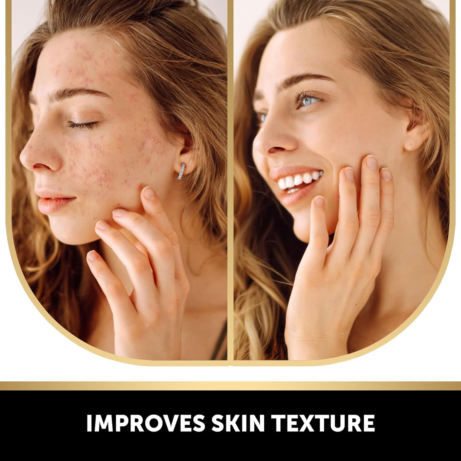 VALITIC 4 Pack Kojic Acid Vitamin C & Retinol Soap Bars for Dark Spot & a Pair of Turquoise Exfoliating Gloves for Body Scrubs