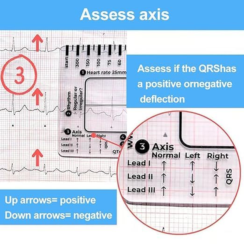 ECG 7Step Ruler,Ecg Ruler Plastic Ruler Measuring Tool,Ecg 7Step Ruler for ECG/EKG Interpretation,Transparent EKG Calipers 7Step Ruler,Follow a 7Step Plan ID Sized for Nurse or One in Healthcare (2) image number 2