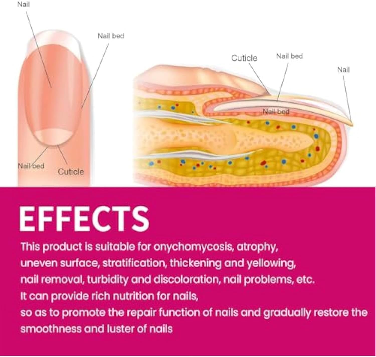 Fungigone Nail Treatment, Fungigone Nail Fungus Removal, 7 Days Nail Fungus Treatment for Toenail, Foot F-Ungus Treatments Nails Care Solution for Toenails & Fingernails (3 PC) - 2 Pc image number 2