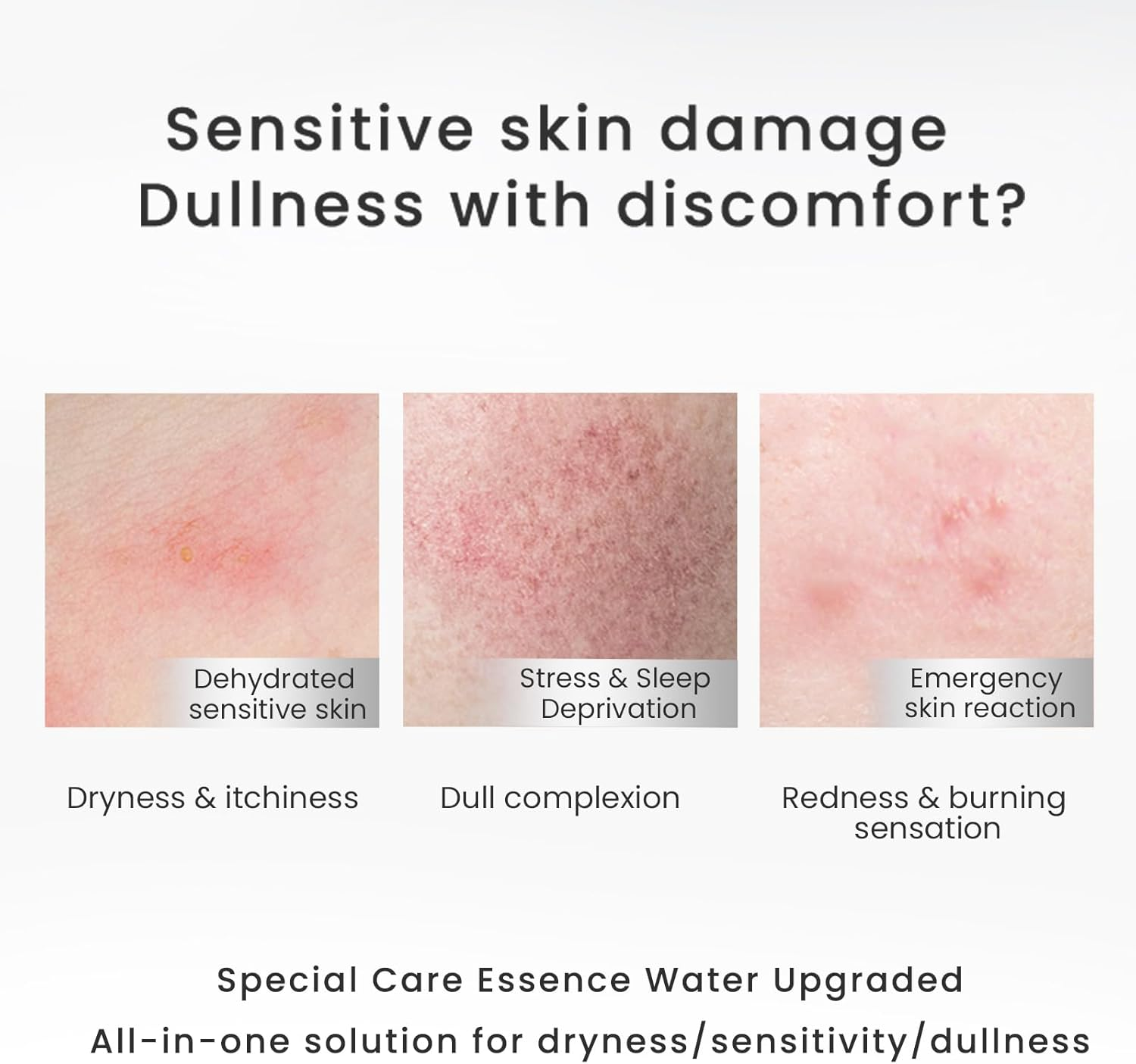 WINONA Facial Toner,Sensitiveness Relieving Moisturizing Tolerance-Extreme Lotion,Soothing and Moisturizing for Sensitive Skin,Hydrating Toner with Hyaluronic Acid for Daily Use (120Ml/4.06 Fl. Oz) image number 1