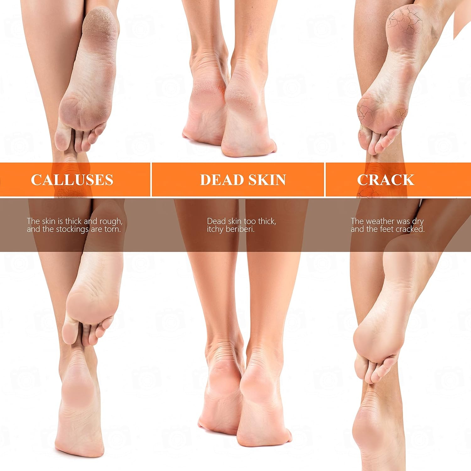 Fotwen Updated 2021 Nano Foot Scrubber Callus Remover, Foot Care Pedicure Tool, Foot File with Nano-Level Grinding Points, Great for Dead Skin Removal, Cracking, Wet and Dry Feet image number 1