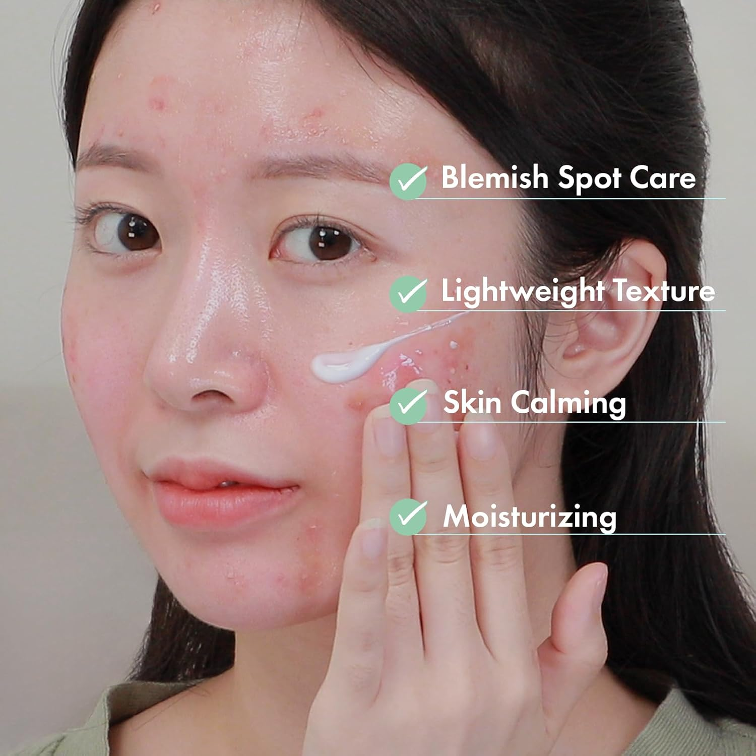 NATUREONE AC Kill Cream, BHA & Salicylic Acid Face Moisturizer, Niacinamide for Active Skin Repair, Tea Tree Oil for for Soothing Sensitive Skin, Acne Spot Treatment Korean Skincare, 30G, 1.05 Oz. image number 4