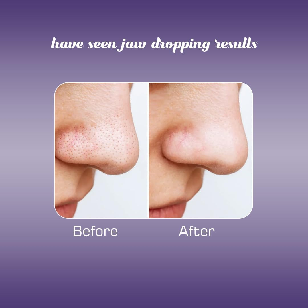 Aayuleubeda Badi Care Abc - Charcoal Nose Strips for Blackhead Remover & Pore Cleanser (6 Strips) image number 4